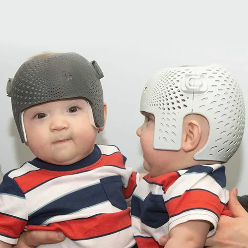 How To Prevent Flat Head Syndrome
