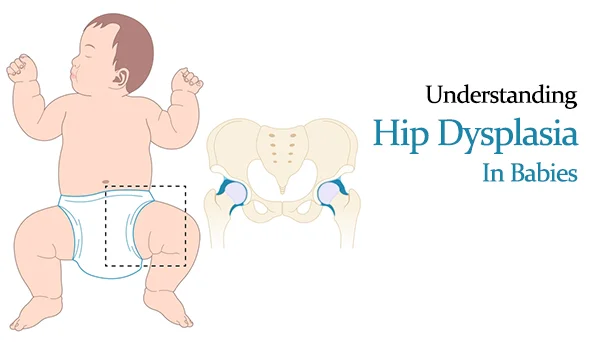 Newborn Hip Development